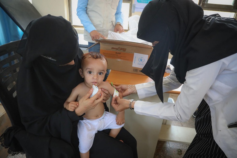 Ein ein Jahr und sieben Monate alter Junge aus dem Jemen wird mit Zusatznahrung gefüttert und auf Unterernährung untersucht.