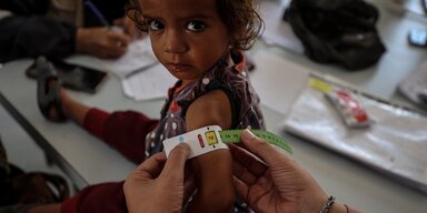 Ein Kleinkind sitzt auf einem Tisch und wird bei den wöchentlichen oder zweiwöchentlichen Kontrolluntersuchungen auf akute Unterernährung untersucht. © WFP/Ali Jadallah