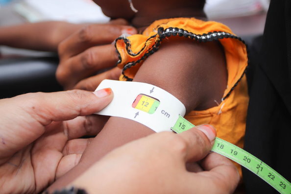 WFP/Alaa Noman, Mutter im Gesundheitszentrum. Eine ihrer Töchter, 1 Jahr und 4 Monate alt, leidet an Mangelernährung. Die Mangelernährung von Kleinkindern im Jemen nimmt zu, da sich die Bedingungen verschlechtern. WFP unterstützt Kinder und Mütter im Jemen bei der Behandlung und Vorbeugung von Mangelernährung.